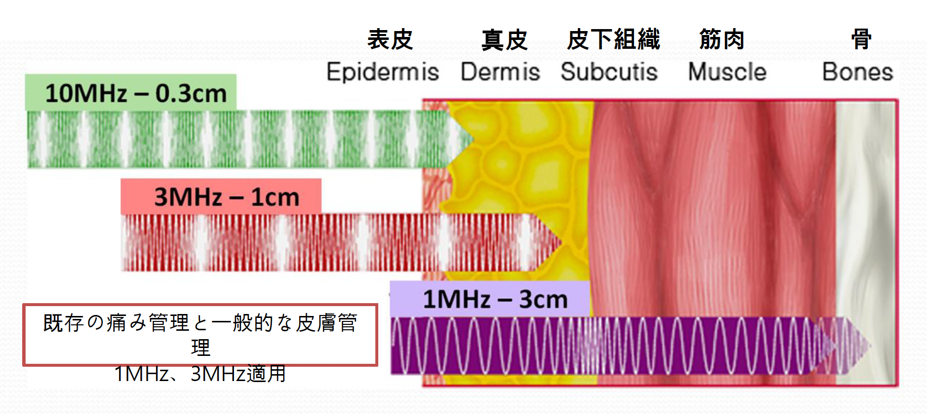 周波数と到達深度の比較（10MHz/3MHz/1MHz）