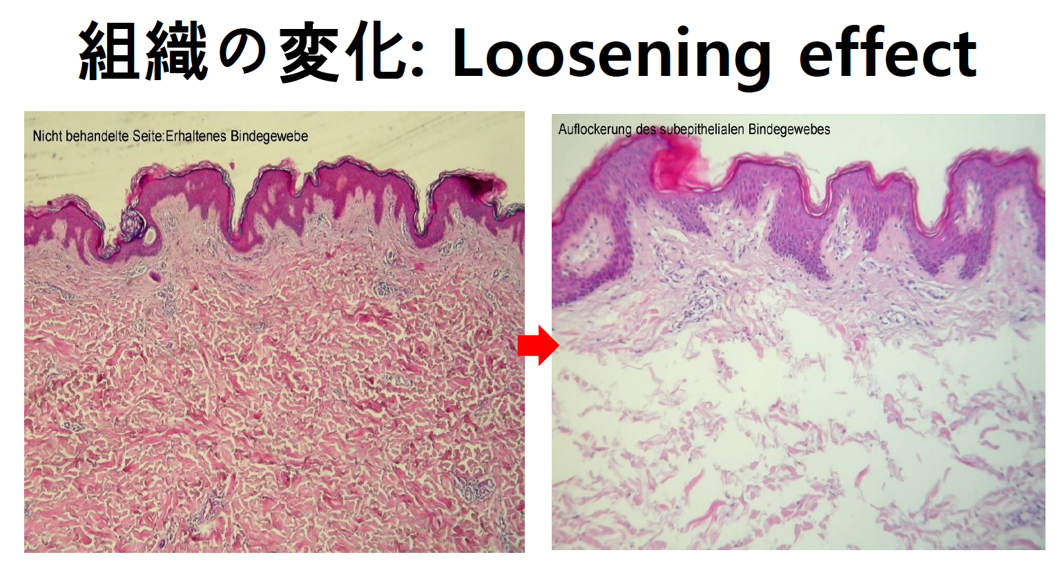 組織の変化 Loosening effect 照射前後の顕微鏡画像