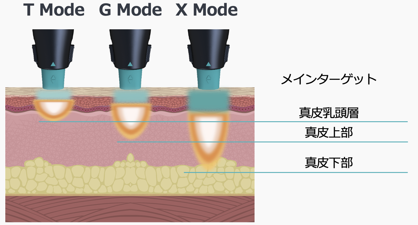 T Mode / G Mode / X Mode 深度イメージ