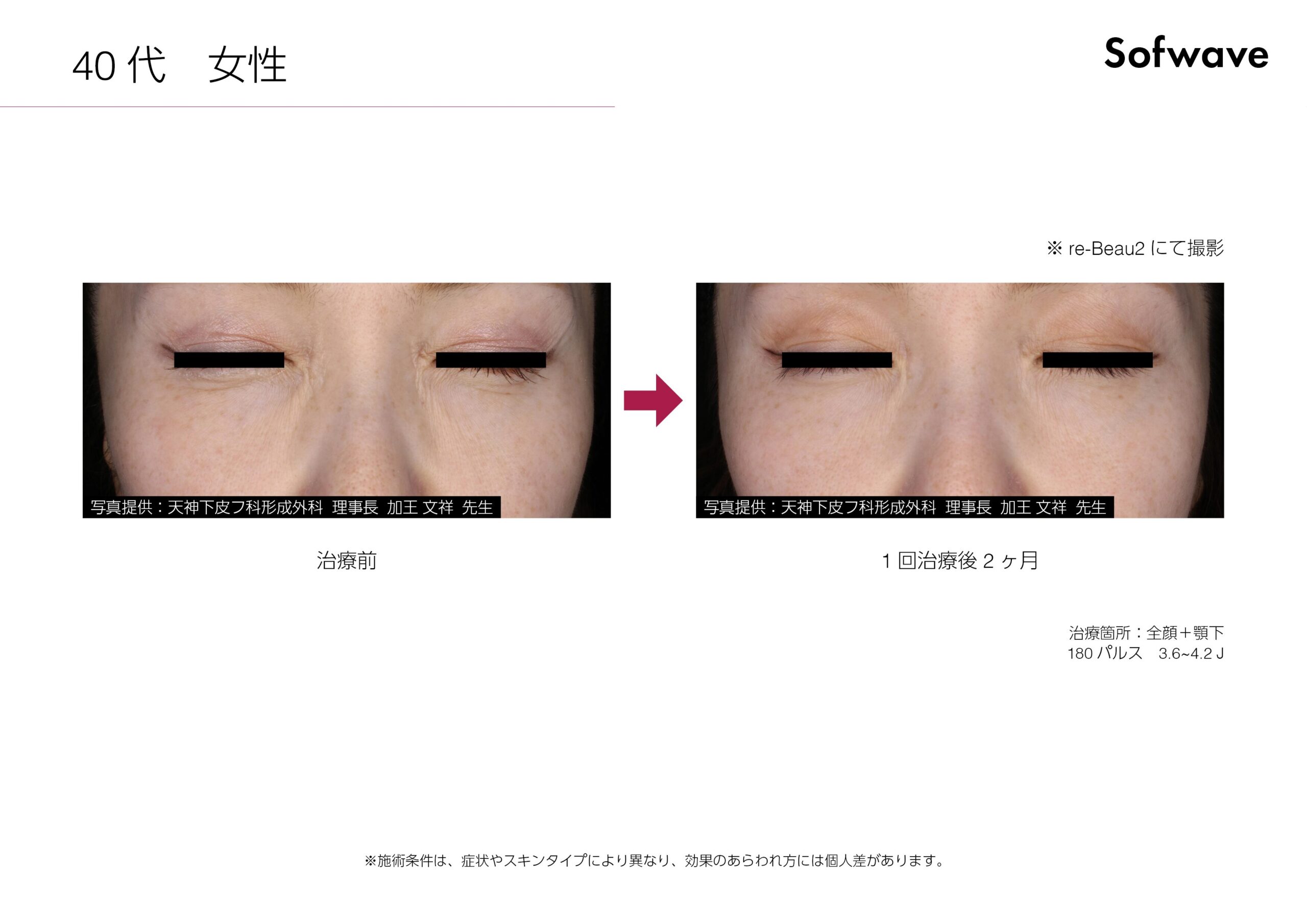 症例写真 Case1