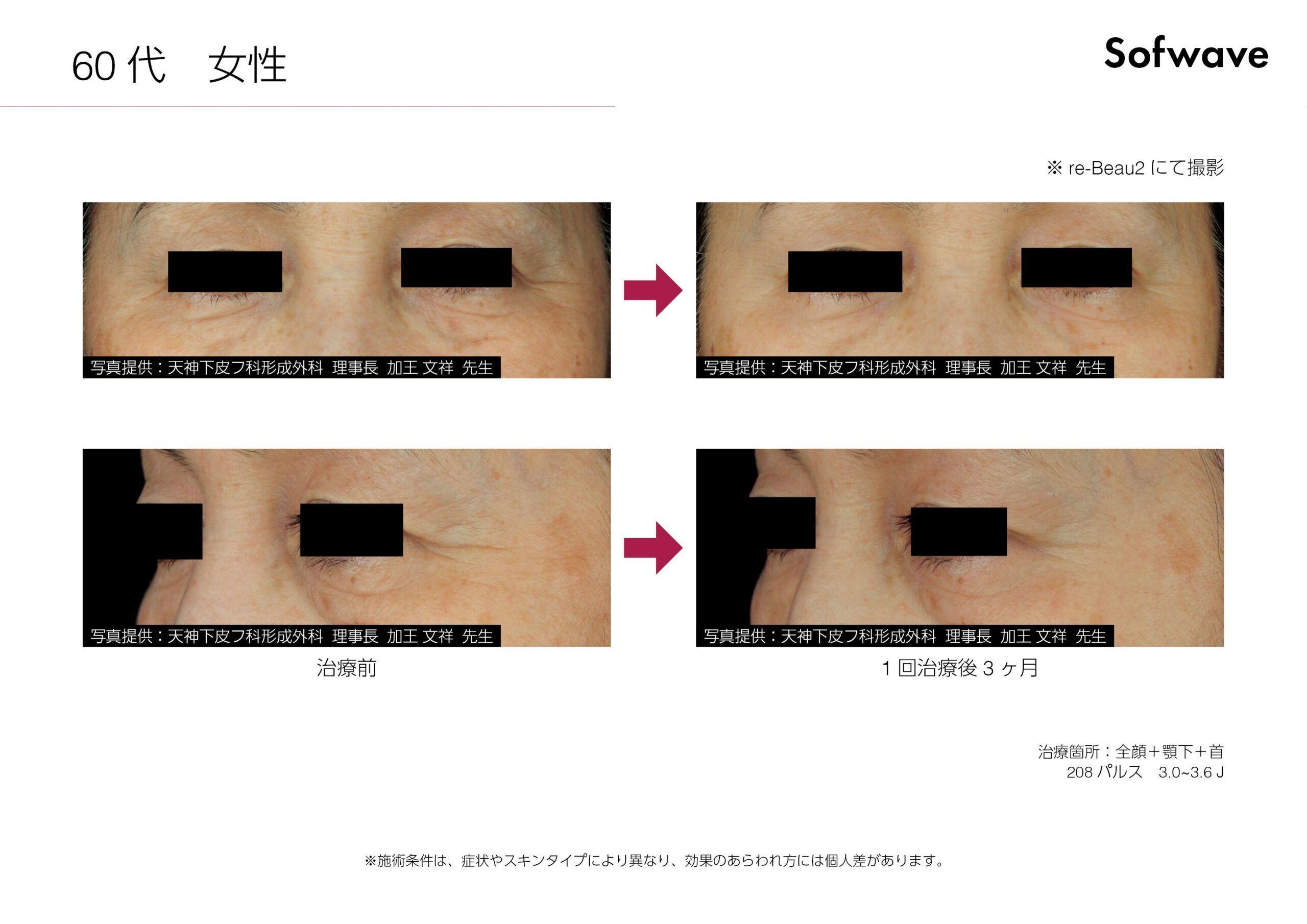 症例写真 Case5