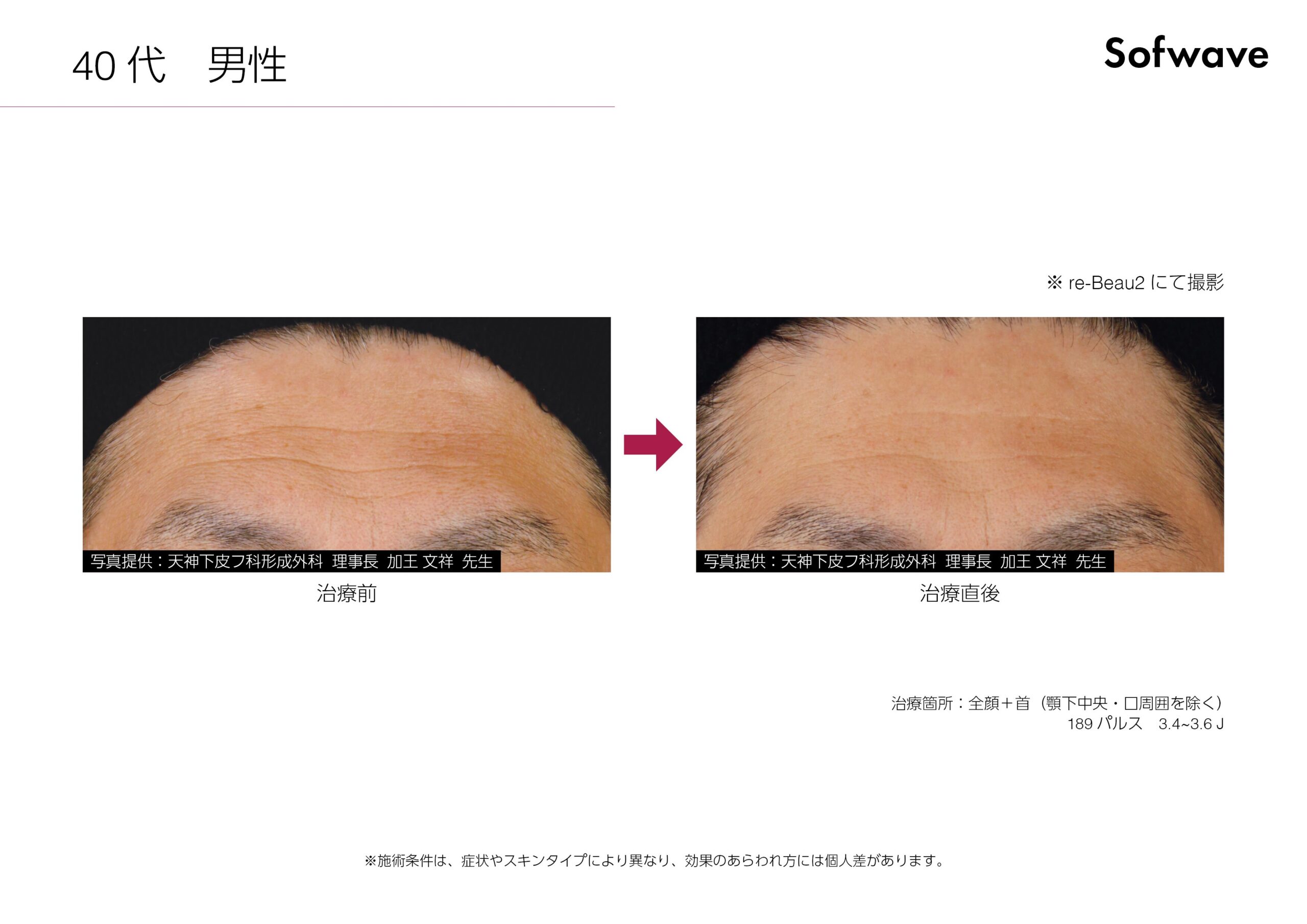 症例写真 Case6