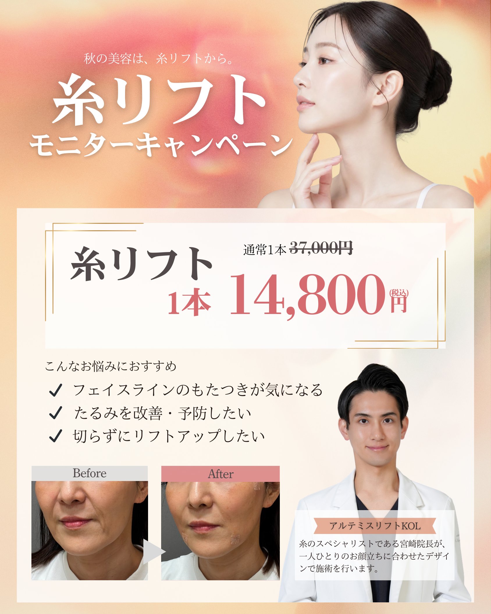 糸リフトモニターキャンペーン